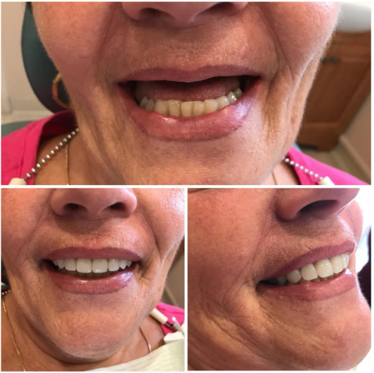 Before-and-after photos of a patient treated by Dr. Klele (case 3)